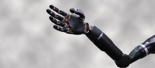 Robotic Prosthetic Hand